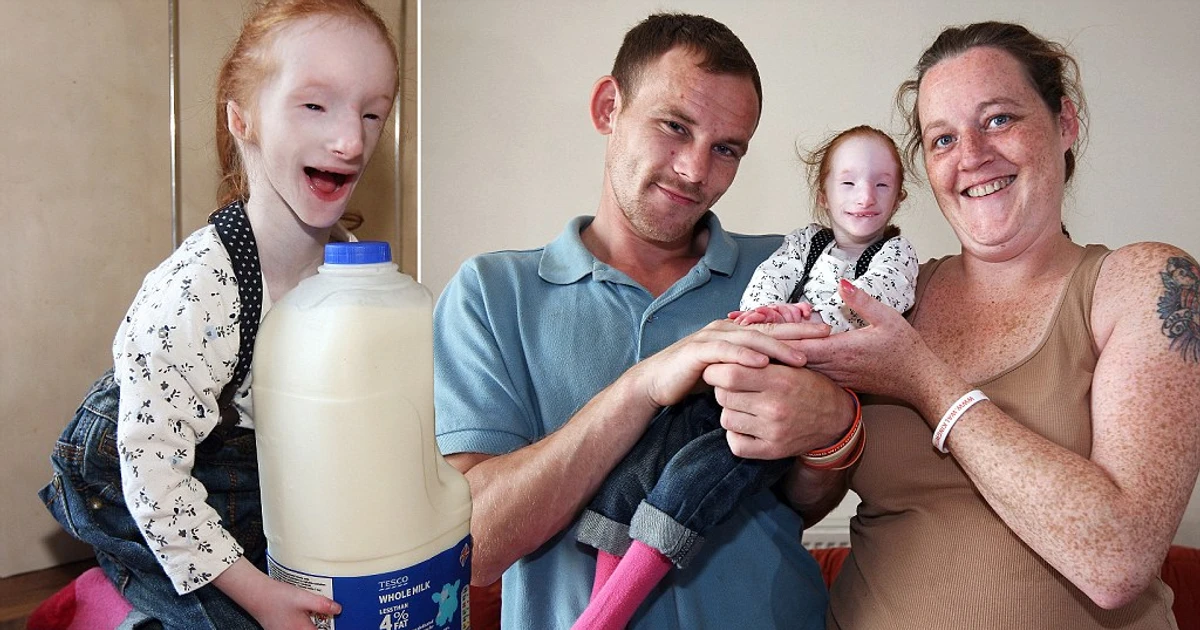 Charlotte Garside - The World's Smallest Girl [2024 Update]